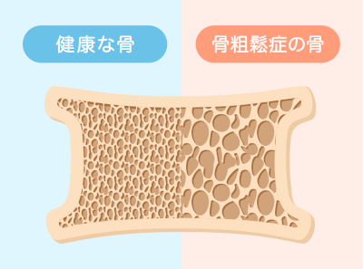 いつ医師または他の医療専門家に連絡すべきですか?